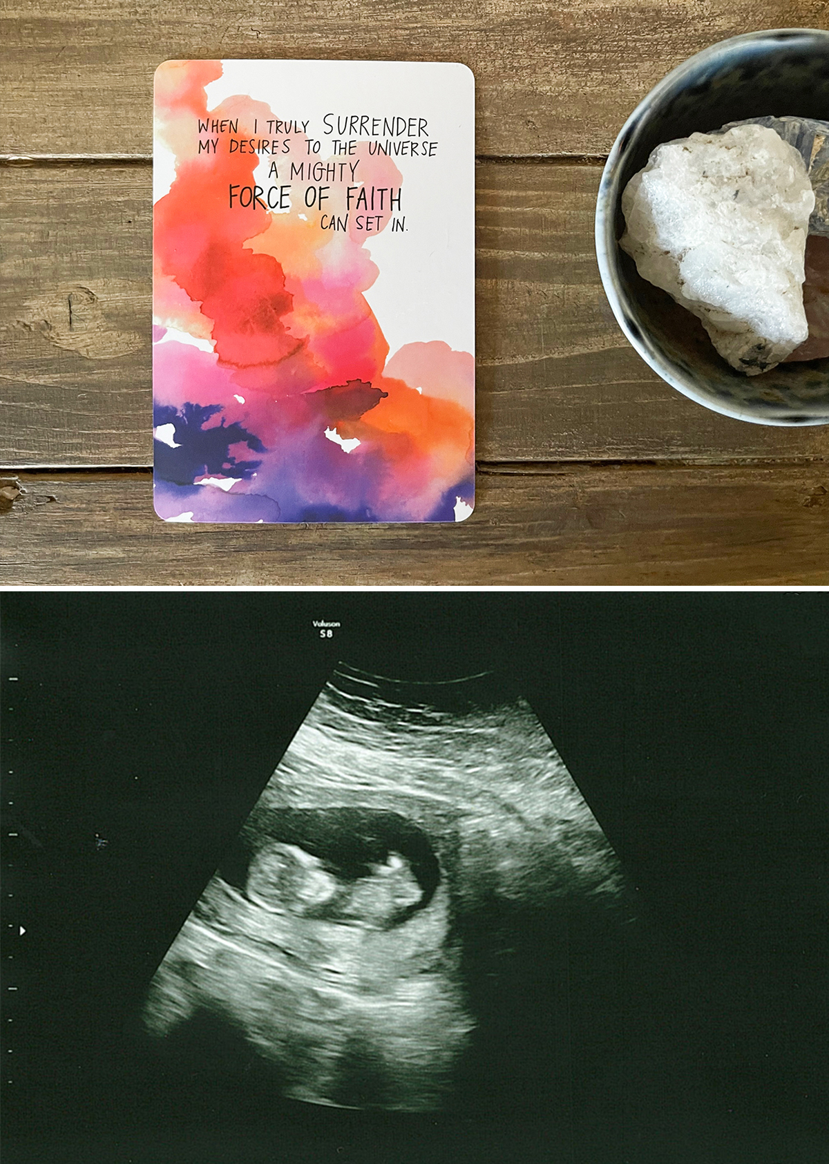 Our Amazing 12 Week Ultrasound (after recurrent pregnancy loss)